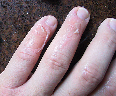 Mental Note:  Boiling oil = HOT!
